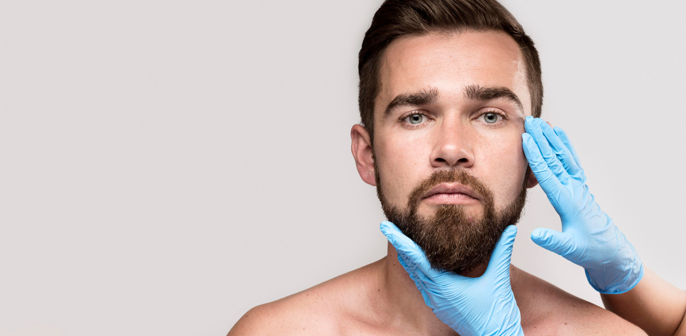 Best Beard Fillers