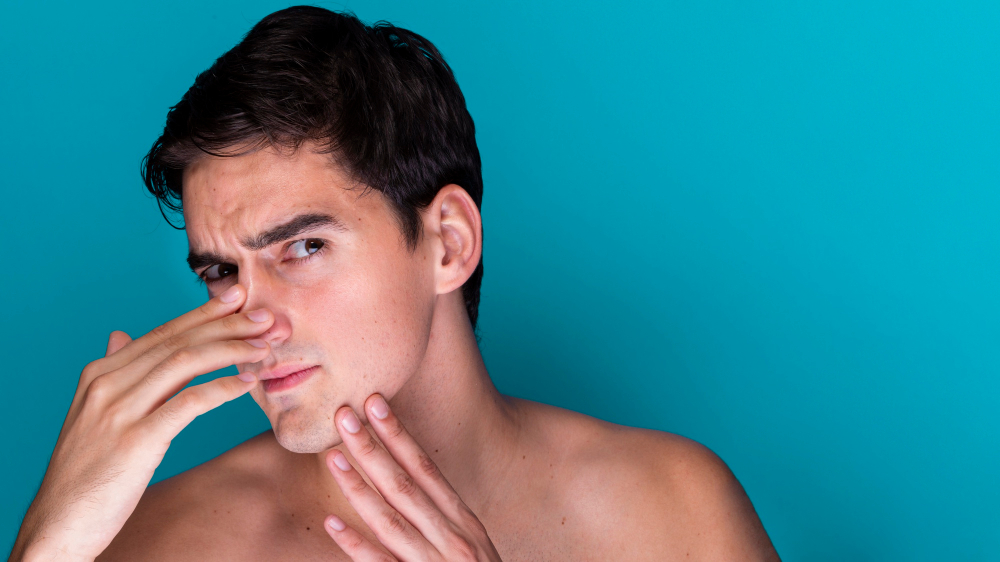 Best Acne Treatment for Men
