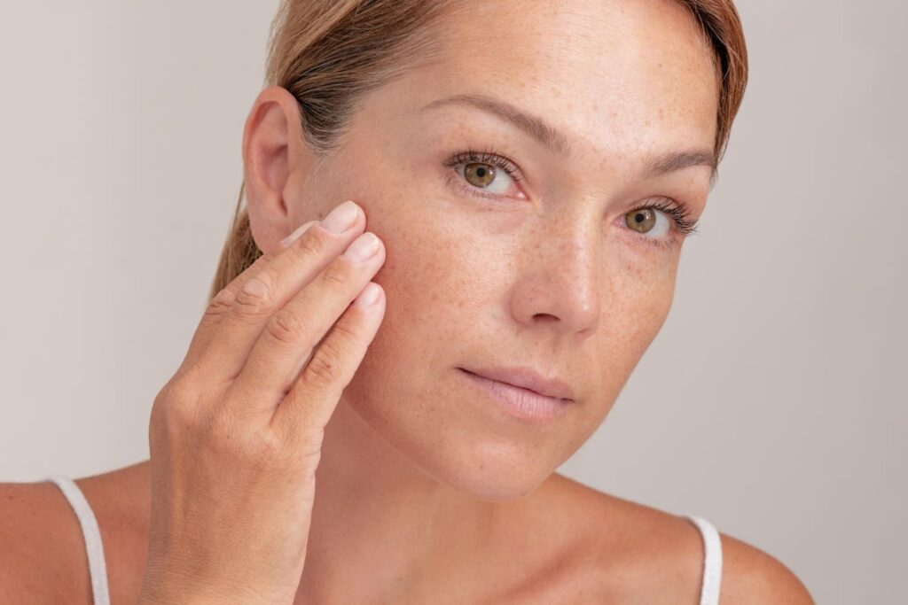 woman with freckles face touching skin 1